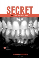 secret1